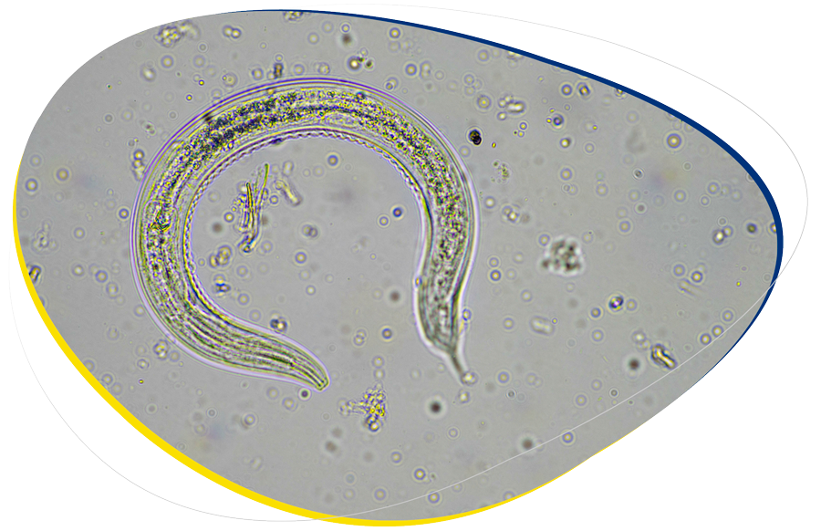 Se muestra un nematodo visto a través de un microscopio.
