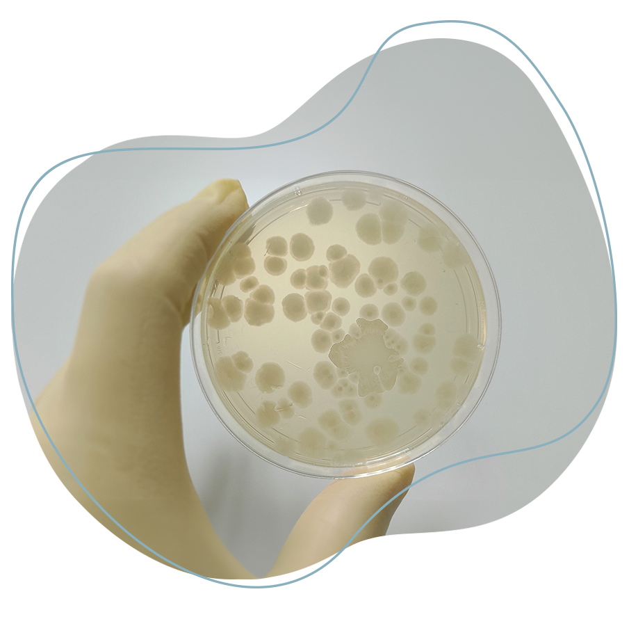 En la imagen se observa ejemplo de la bacteria llamada Bacillus subtilis en plato petri para el control de larvas de mariposas.